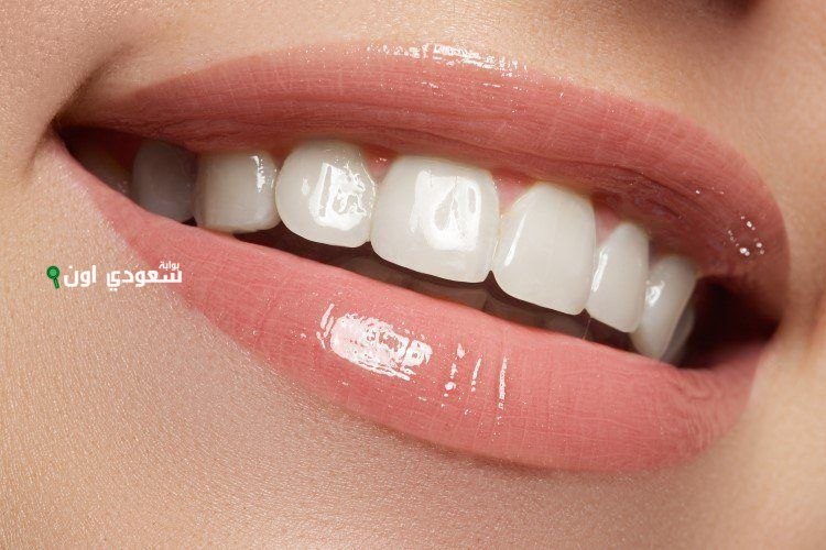 احصل على ابتسامة هوليود في اسبوع