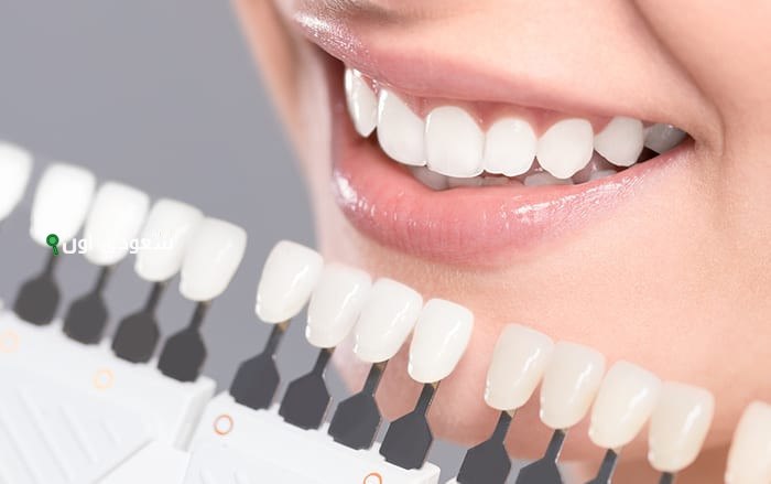 ادعكي أسنانك بالمكون ده ومش هتصدقي درجة البياض