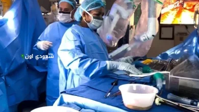 للمرة الأولى عالميًا زراعة جهاز دعم بطيني مزدوج بالروبوت