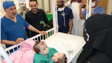 عملية فصل التوأم المُلتصق السوري