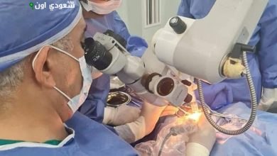 مستشفى الهلال للتأمين الصحى بسوهاج يجري 11 عملية زراعة قوقعة للأطفال