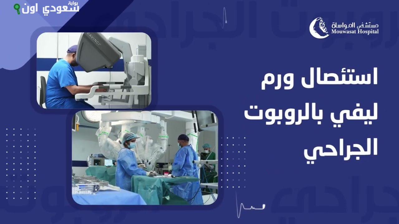 الصورة الرئيسية للمقال: مستشفى المواساة يحقق إنجازاً برؤية جراحية روبوتية لفتق فيمورالي للسيدات