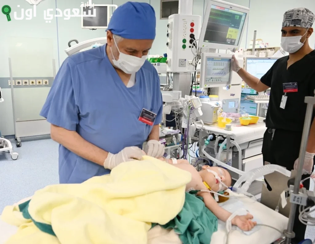 نجاح عملية فصل التوأم