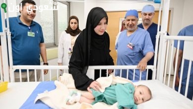 السعودية تحقق إنجاز طبي جديد بفصل التوأم الطفيلي المصري في الرياض