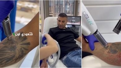 أحمد سعد يتخلص من التاتو