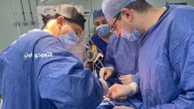 نجاح عملية بالمنظار تنهي معاناة مريض كرونز