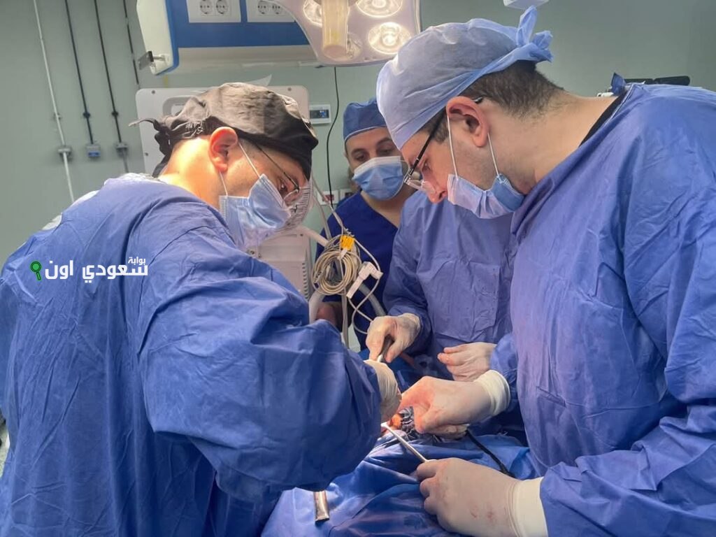 نجاح عملية بالمنظار تنهي