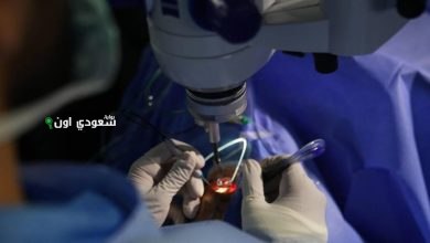 مركز صحة العين بمدينة الملك عبدالله الطبية
