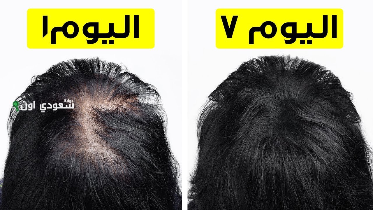 الطريقة الي هتطول لك شعرك من غير أدوية وشامبوهات غالية