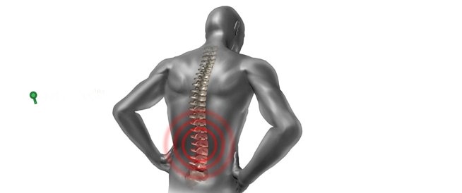 علاج خشونة الركبة بالأعشاب الطبيعية