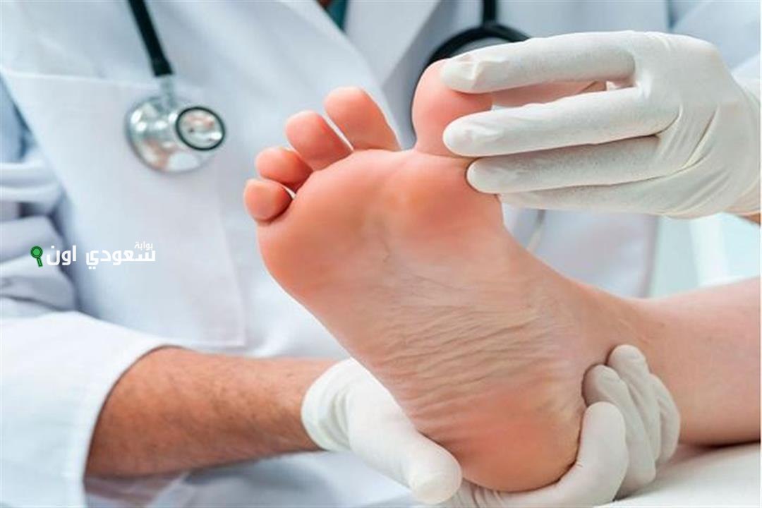 تحذيرات طبية هامة للأشخاص المصابين بالسكري