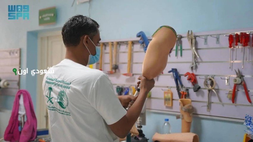 مشروع الأطراف الصناعية في حضرموت يحقق خدمات للـ 775 مستفيداً خلال شهر واحد