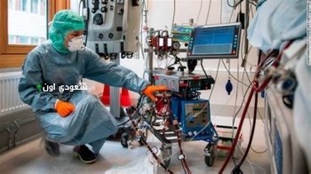 تقنية ECMO الطريقة التي