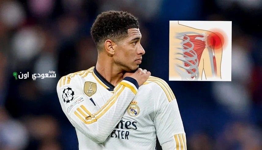 ريال مدريد يعتزم إجراء جراحة لجود بيلينجهام لعلاج إصابة الكتف التي تؤثر على أدائه