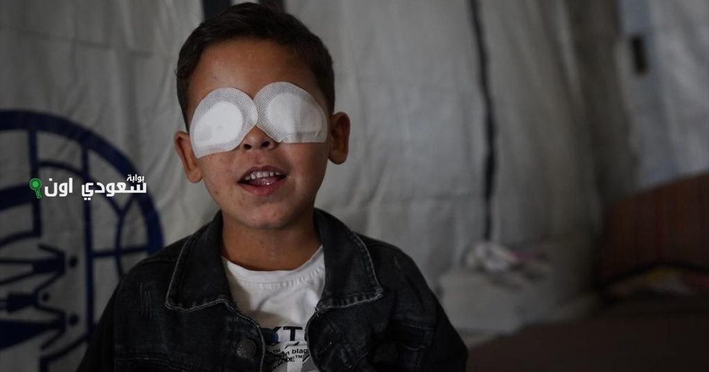 الطفل الفلسطيني محمد حجازي يفقد بصره ونعمل على شفائه