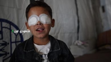الطفل الفلسطيني محمد حجازي يفقد بصره ونعمل على شفائه