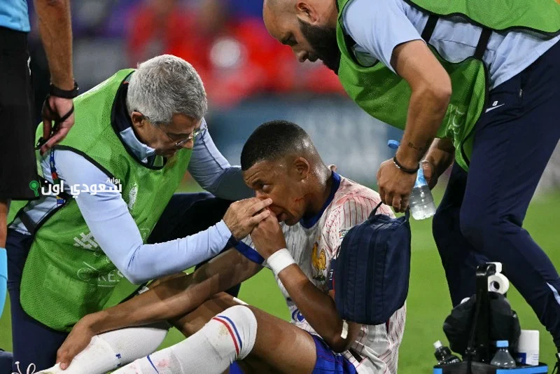 ريال مدريد يكشف تفاصيل إصابة مبابي ونقله الفوري إلى المستشفى للعلاج الفوري