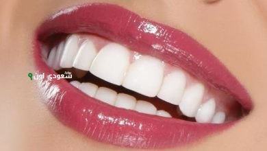 احصل على ابتسامة هوليود في اسبوع