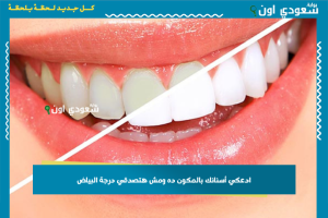 ادعكي أسنانك بالمكون ده ومش هتصدقي درجة البياض