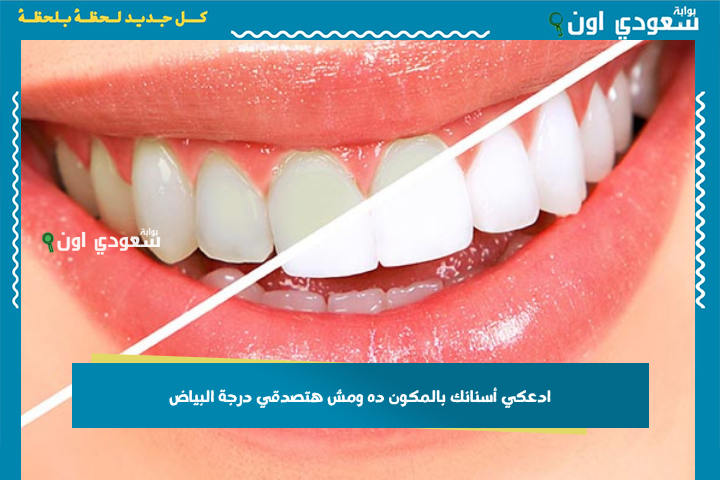ادعكي أسنانك بالمكون ده ومش هتصدقي درجة البياض اللي هتحصلي عليها من أول استخدام
