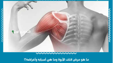 ما هو مرض كتف الأبوة وما هي أسبابه وأعراضه؟!