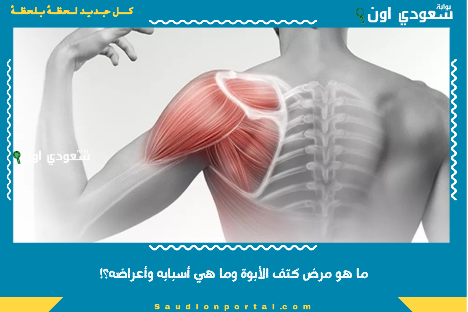 ما هو مرض كتف