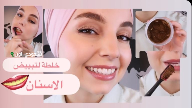 اقوى وصفة طبيعية لتبييض الاسنان في يوم واحد بمكونين فقط من مطبخك النتيجة هتبهرك