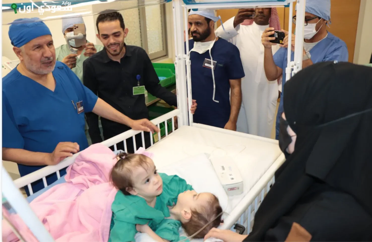 عملية فصل التوأم المُلتصق السوري