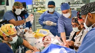 نجاح عملية فصل التوأم السعودي الملتصق «لارا ويارا»