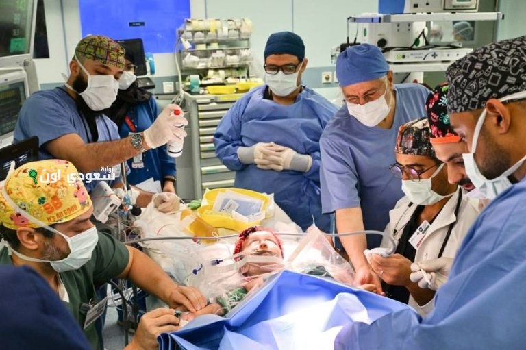 نجاح عملية فصل التوأم السعودي الملتصق «لارا ويارا»