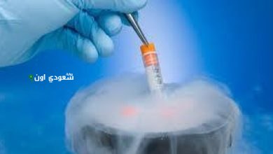 شروط جواز تجميد الخلايا المنوية وفقًا للفتاوى الشرعية