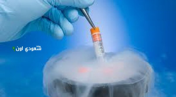 شروط جواز تجميد الخلايا المنوية وفقًا للفتاوى الشرعية