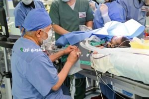 بدء فصل التوأم السيامي السعودي
