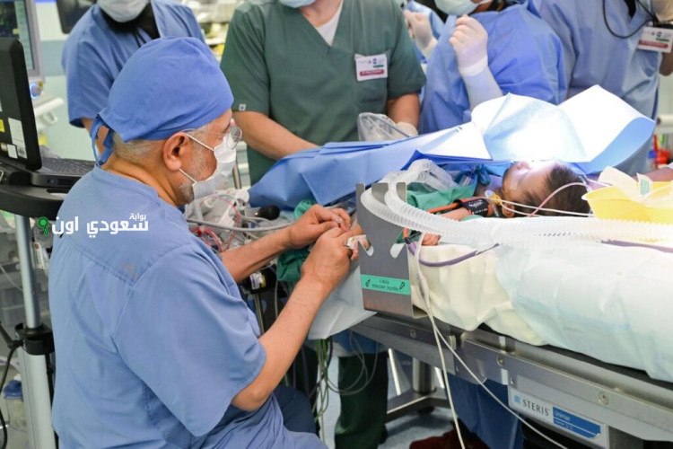 عملية من 9 مراحل وتستغرق 15 ساعة! بدء فصل التوأم السيامي السعودي «يارا ولارا»