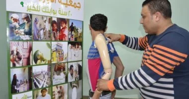 توزيع 20 جهاز تعويضي وطرف صناعي لذوي الهمم بأسوان