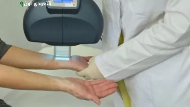 جهاز حديث لعلاج مرض البهاق