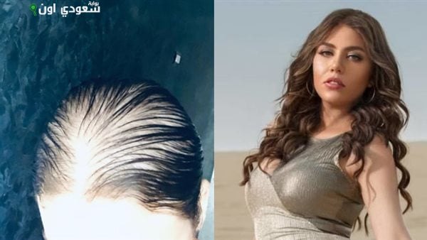 الفنانة رحمة حسن