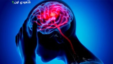 الأشخاص الذين تعرضوا لسكتة دماغية قد يواجهون مخاطر الشلل