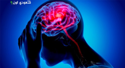 الأشخاص الذين تعرضوا لسكتة دماغية قد يواجهون مخاطر الشلل