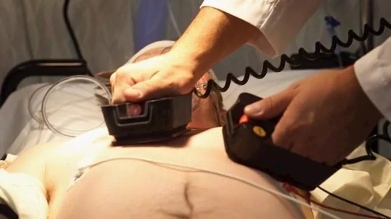 إنقاذ مريض بعد توقف قلبه 46 دقيقة بمستشفى النصر التخصصي في بورسعيد