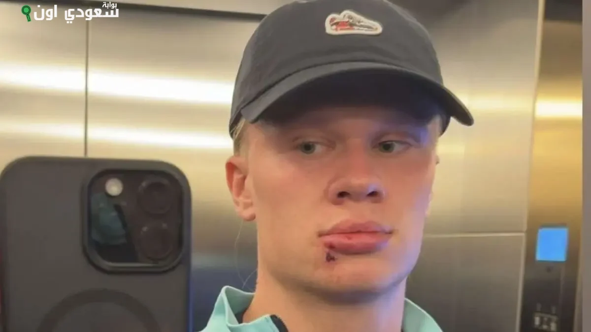 إيرلينج هالاند