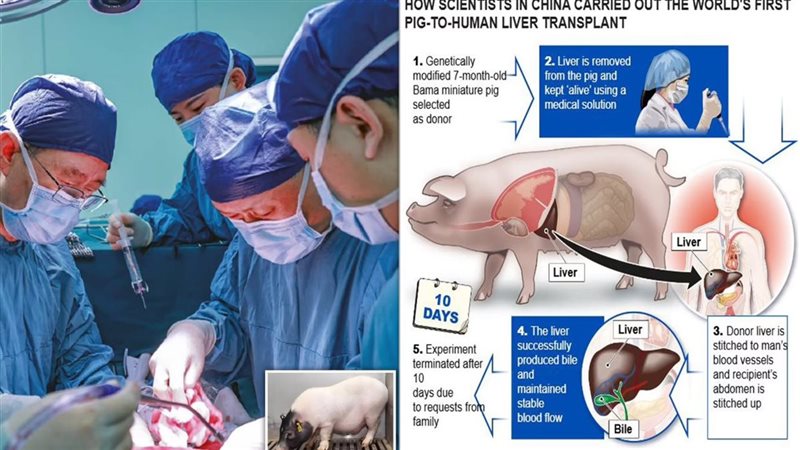 نجاح أول عملية زراعة كبد خنزير